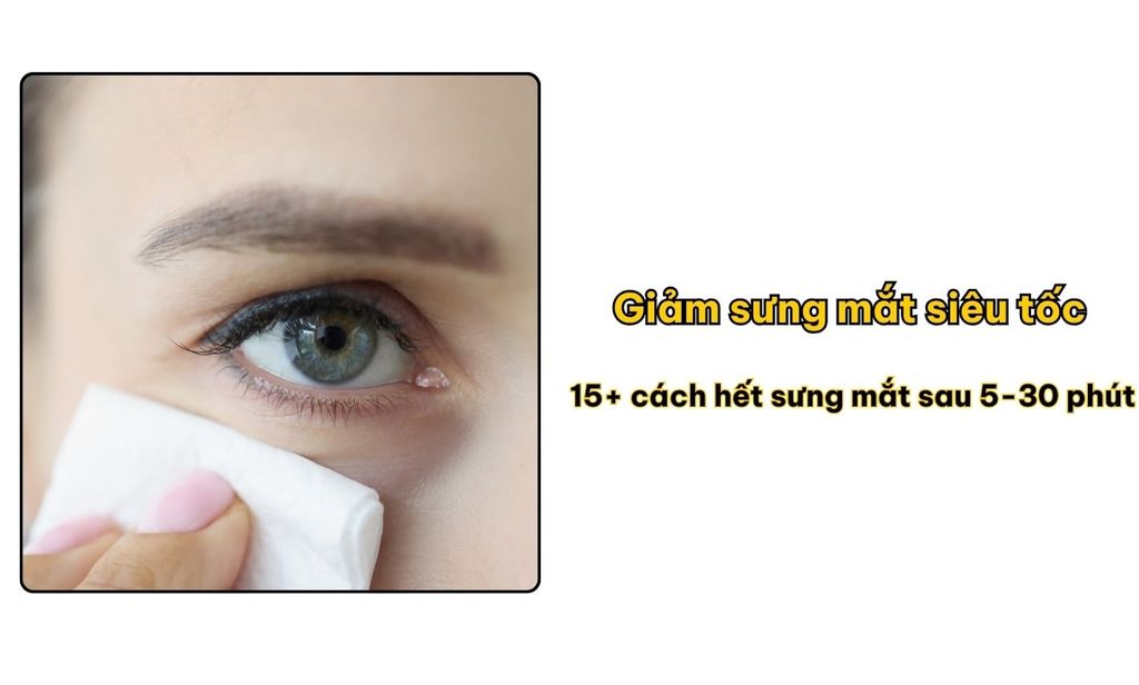 Giảm sưng mắt siêu tốc: 15+ cách hết sưng mắt sau 5-30 phút