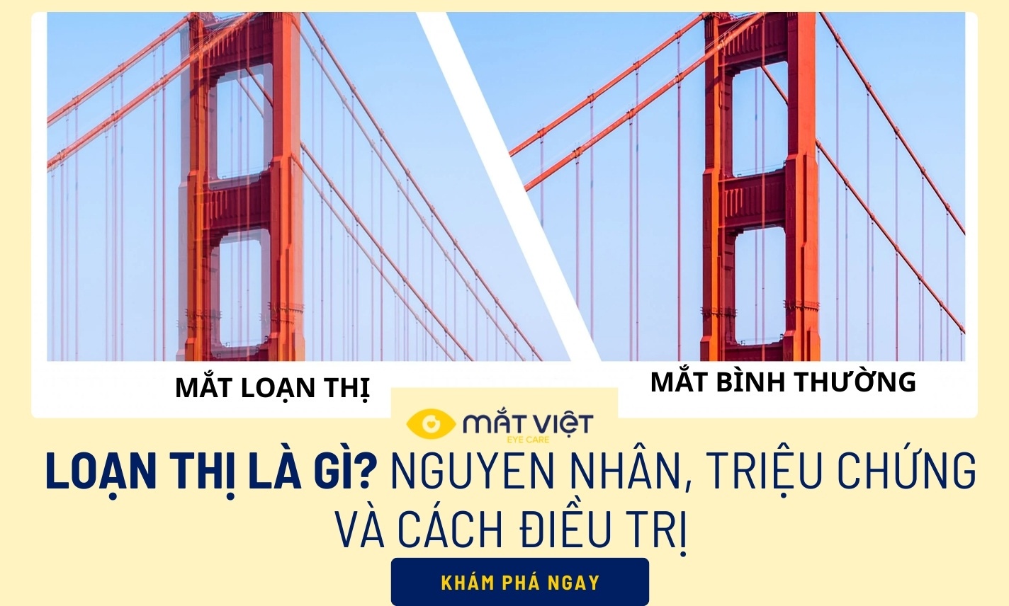 Loạn thị là gì? Nguyên nhân, triệu chứng và cách điều trị