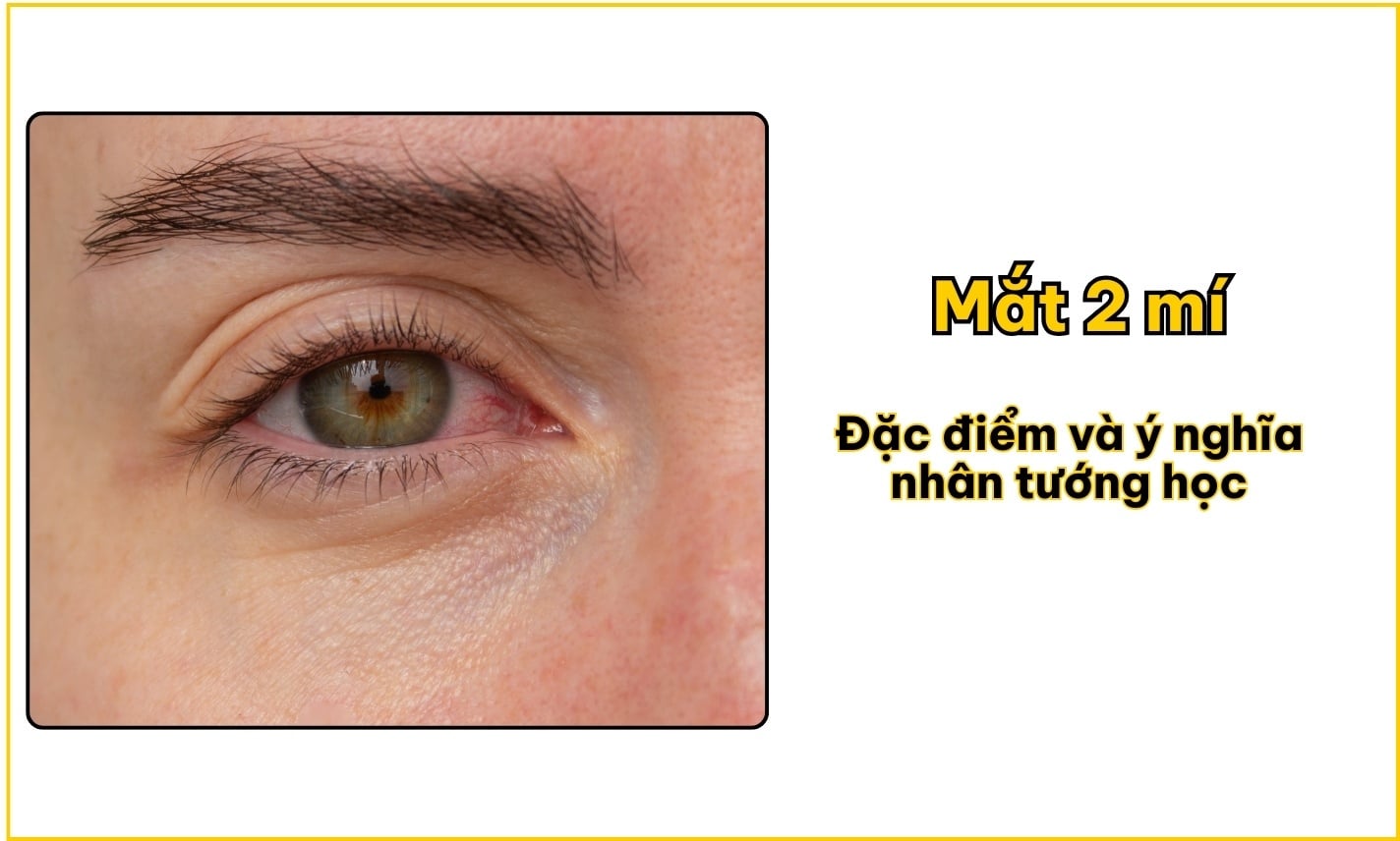 Mắt 2 mí: Đặc điểm và ý nghĩa nhân tướng học