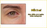 Mắt 2 mí: Đặc điểm và ý nghĩa nhân tướng học