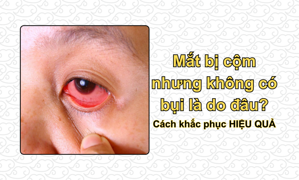Mắt bị cộm nhưng không có bụi là do đâu? Cách khắc phục HIỆU QUẢ