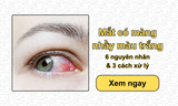 Mắt có màng nhầy màu trắng: 6 nguyên nhân & 3 cách xử lý