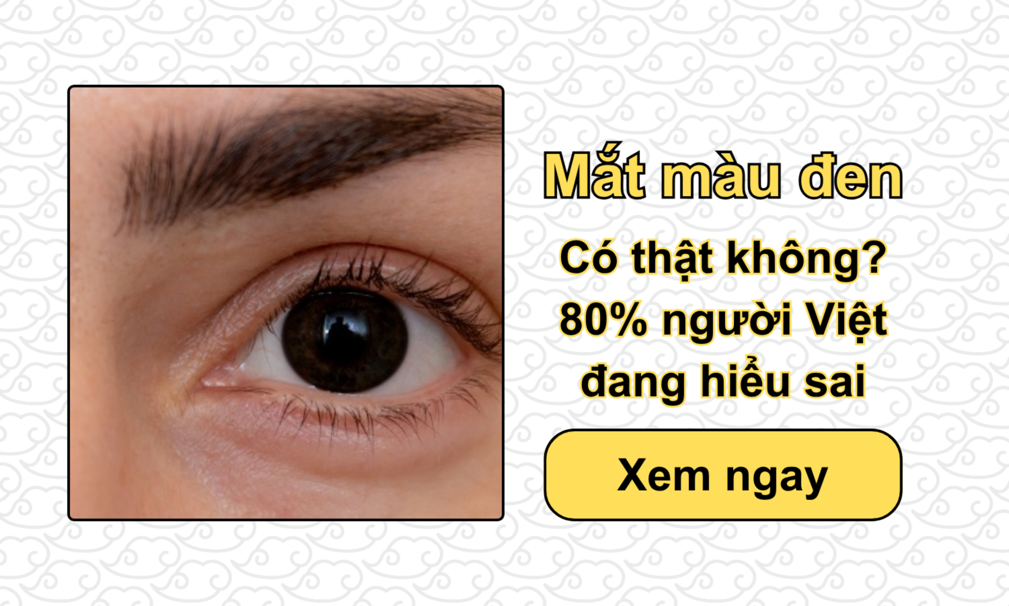 Mắt màu đen có thật không? 80% người Việt đang hiểu sai