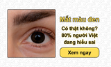 Mắt màu đen có thật không? 80% người Việt đang hiểu sai