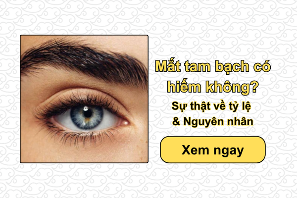 Mắt tam bạch có hiếm không? Sự thật về tỷ lệ & Nguyên nhân