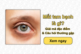 Mắt tam bạch là gì? Giải mã đặc điểm & Câu hỏi thường gặp