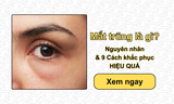 Mắt trũng là gì? Nguyên nhân & 9 Cách khắc phục HIỆU QUẢ