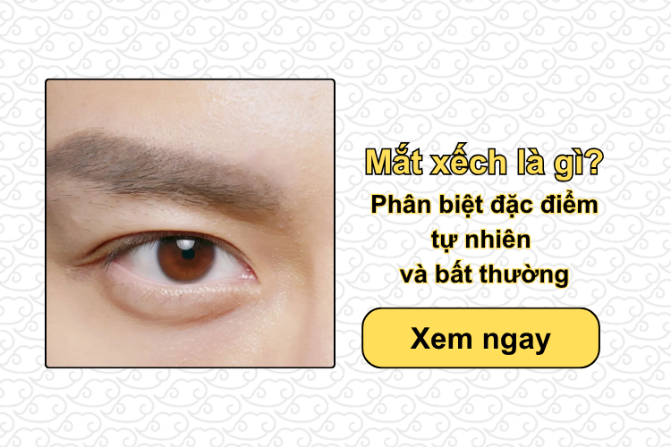 Mắt xếch là gì? Phân biệt đặc điểm tự nhiên và bất thường