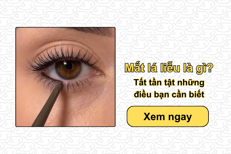 Mắt lá liễu là gì? Tất tần tật những điều bạn cần biết