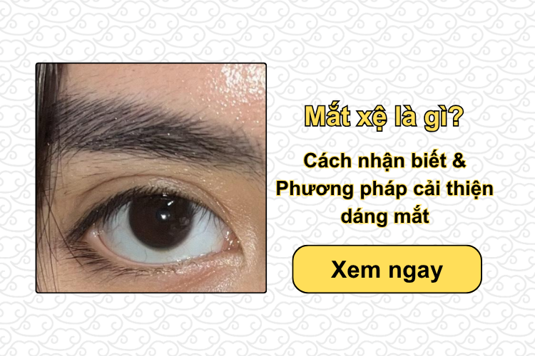 Mắt xệ là gì? Cách nhận biết & Phương pháp cải thiện dáng mắt