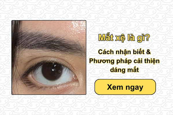 Mắt xệ là gì? Cách nhận biết & Phương pháp cải thiện dáng mắt