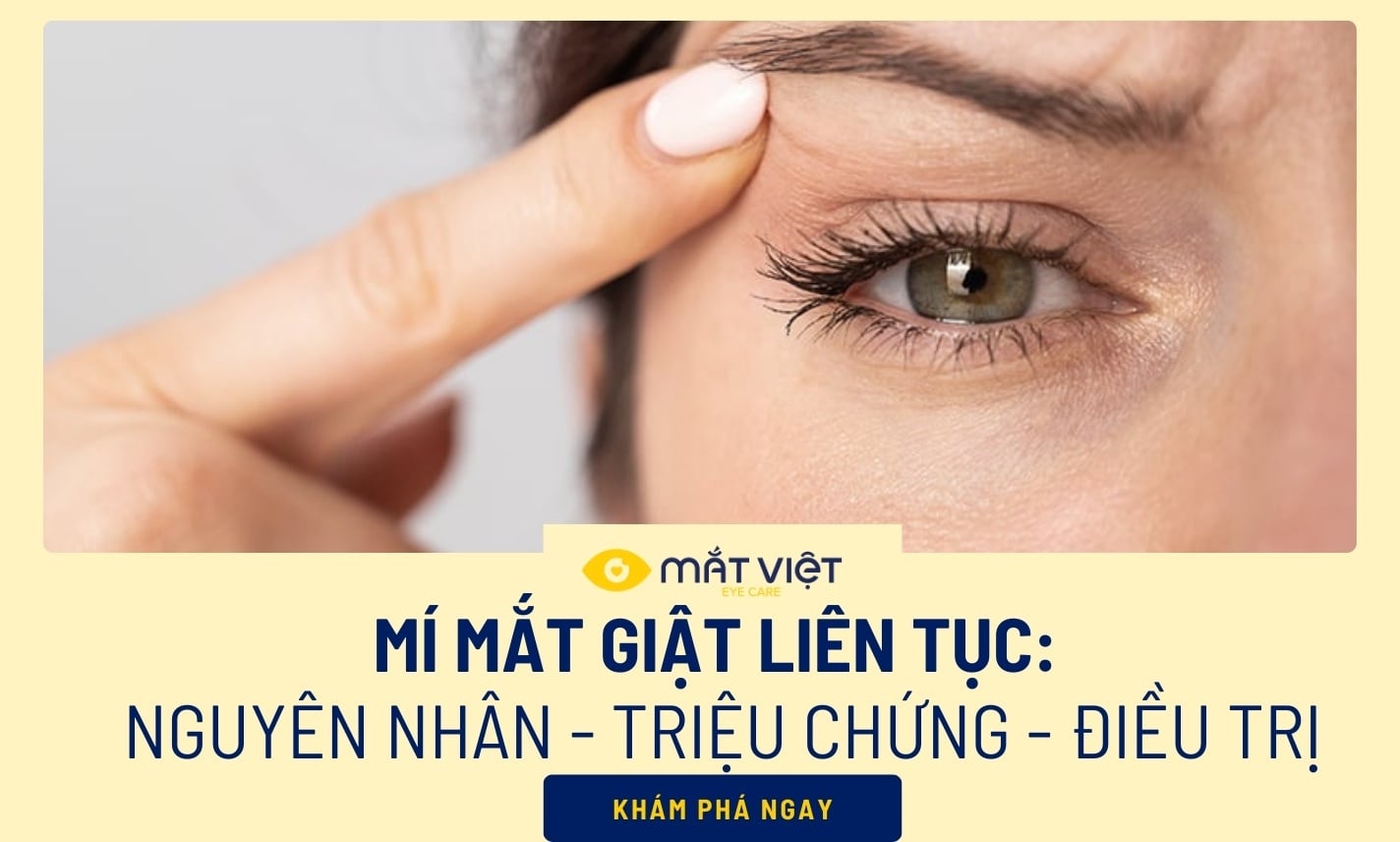 Mí mắt giật liên tục: Nguyên nhân - Triệu chứng - Điều trị