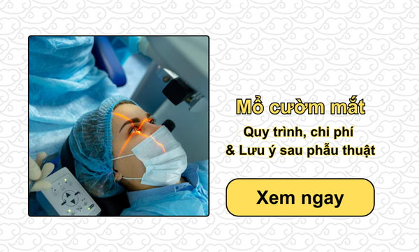Mổ cườm mắt: Quy trình, chi phí & Lưu ý sau phẫu thuật