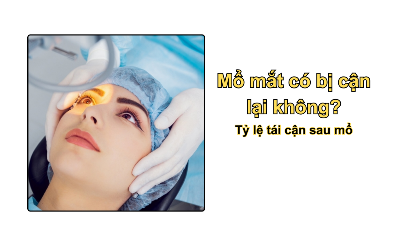 Mổ mắt có bị cận lại không? Tỷ lệ tái cận sau mổ