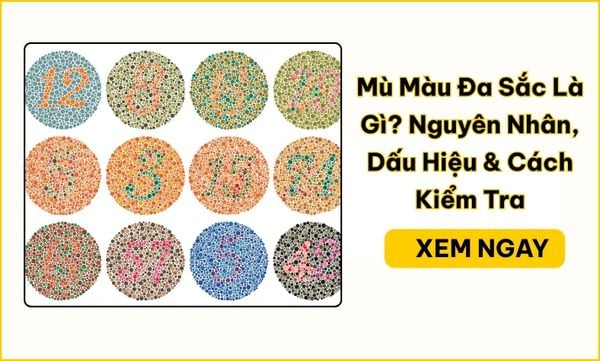Mù Màu Đa Sắc Là Gì? Nguyên Nhân, Dấu Hiệu & Cách Kiểm Tra