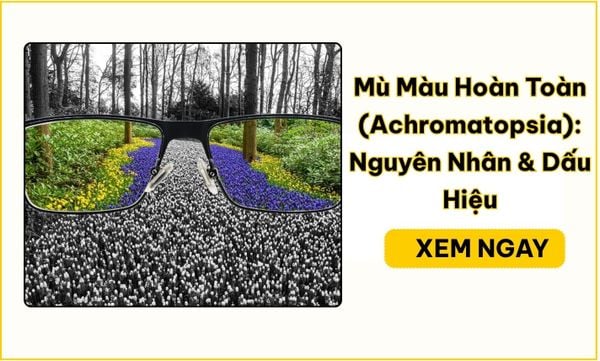 Mù Màu Hoàn Toàn (Achromatopsia): Nguyên Nhân & Dấu Hiệu