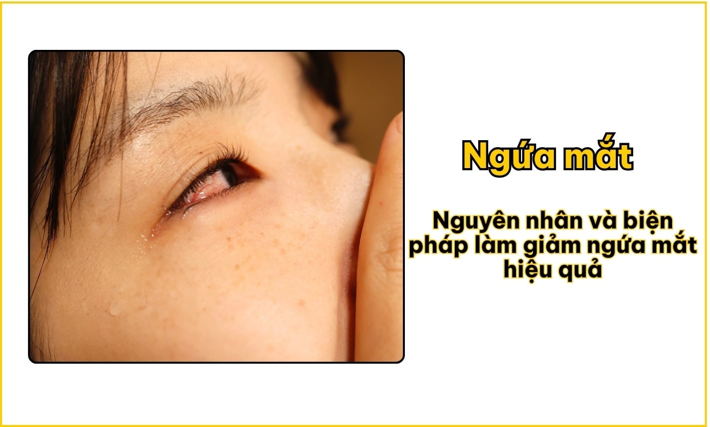 Ngứa mắt: 8 nguyên nhân và 6 cách giảm ngứa hiệu quả