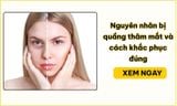 Nguyên nhân bị quầng thâm mắt và cách khắc phục đúng