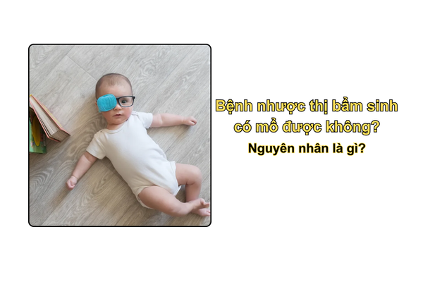 Bệnh nhược thị bẩm sinh có mổ được không? Nguyên nhân là gì?