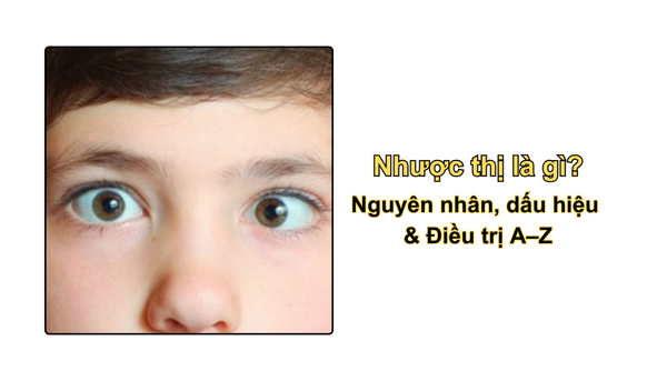 Nhược thị là gì? Nguyên nhân, dấu hiệu & Điều trị A–Z