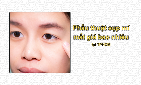 Phẫu thuật sụp mí mắt giá bao nhiêu? Giá CHI TIẾT tại TPHCM