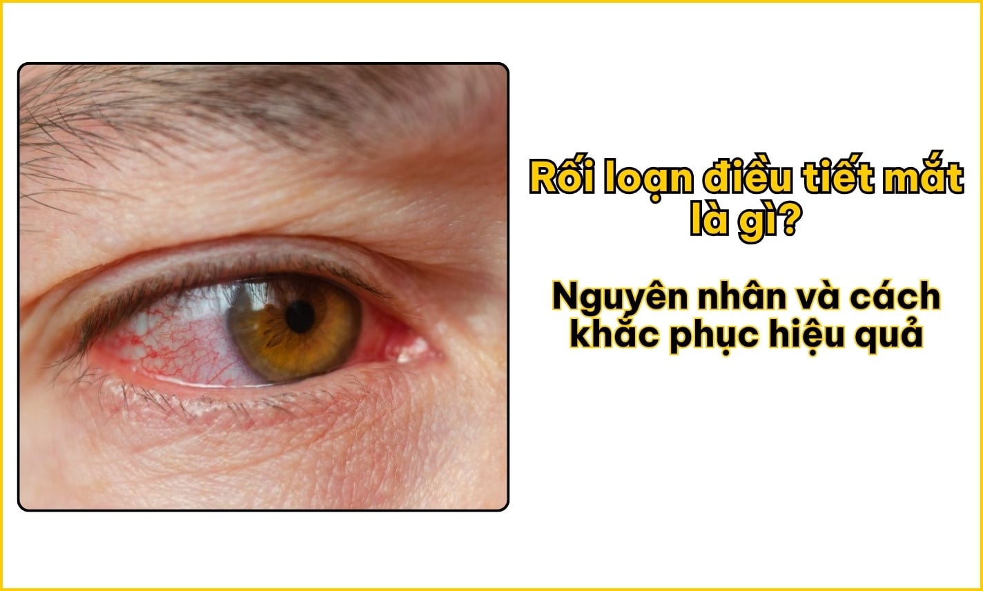 Rối loạn điều tiết mắt là gì? Nguyên nhân và cách khắc phục hiệu quả