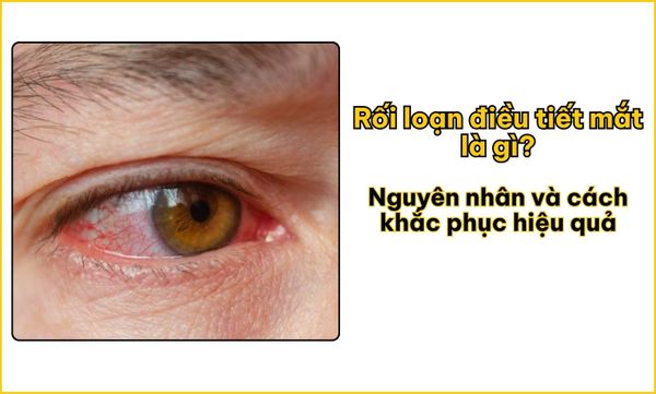 Rối loạn điều tiết mắt là gì? Nguyên nhân và cách khắc phục hiệu quả