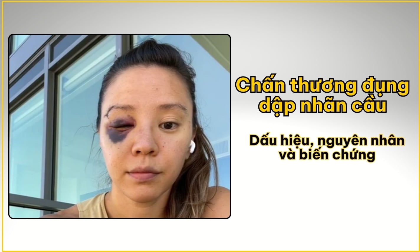 Chấn thương đụng dập nhãn cầu: Dấu hiệu, nguyên nhân và biến chứng