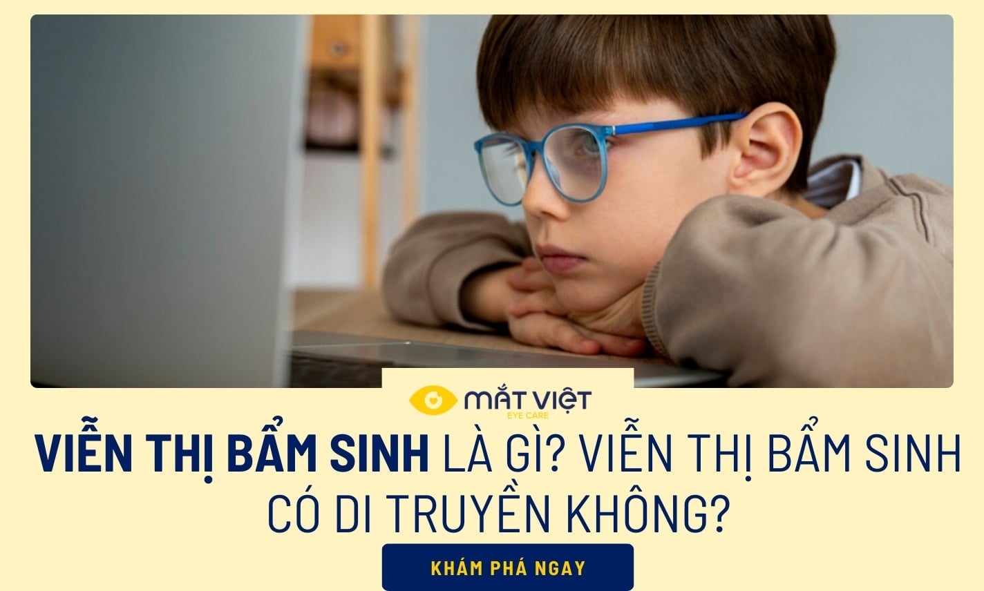 Viễn thị bẩm sinh là gì? Viễn thị bẩm sinh di truyền không?