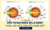 Viễn thị bao nhiêu độ là nặng? Phân loại độ & cách nhận biết