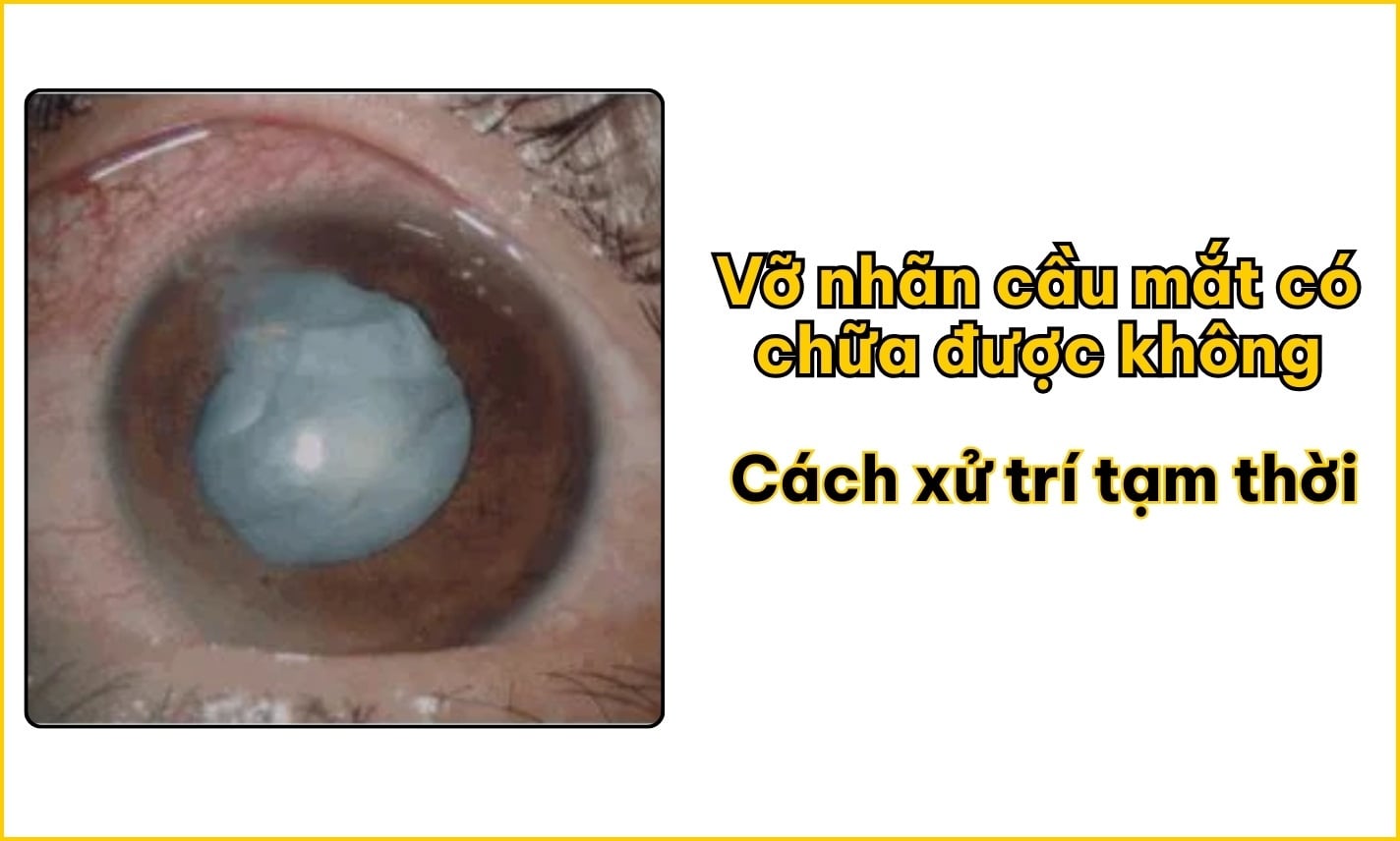 Vỡ nhãn cầu mắt có chữa được không? Cách xử trí tạm thời