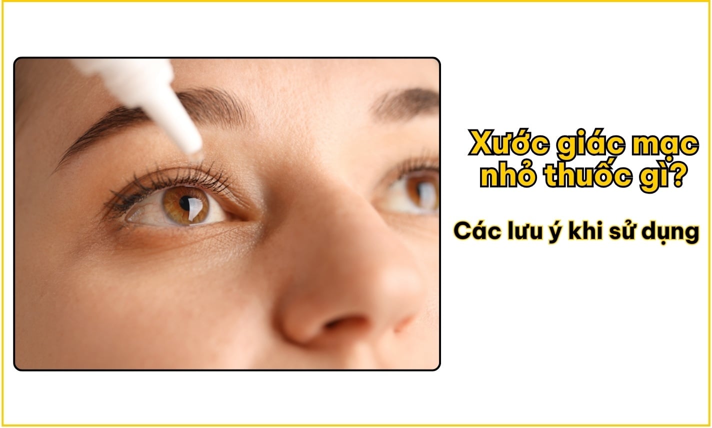 Xước giác mạc nhỏ thuốc gì? Các lưu ý khi sử dụng