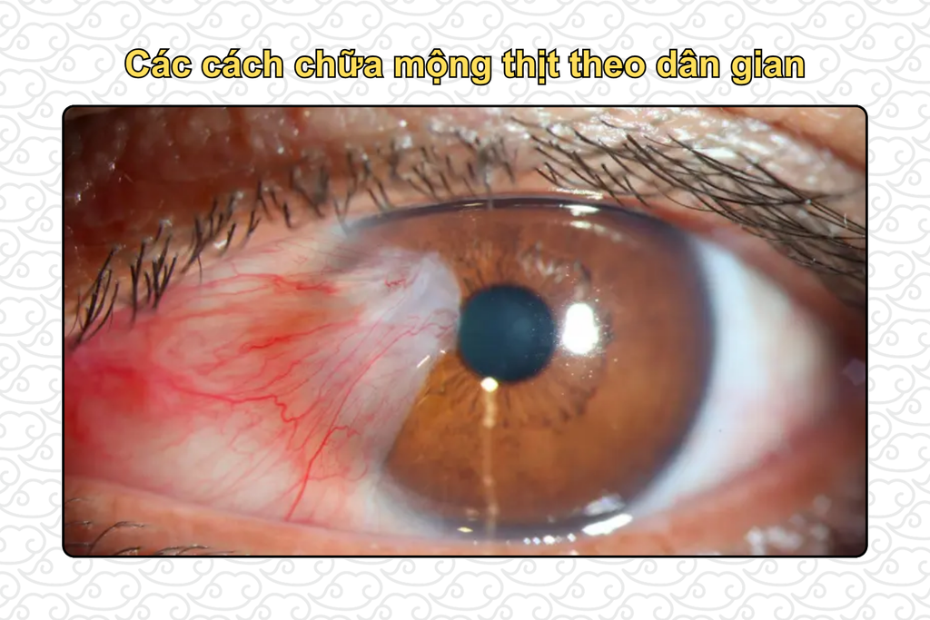 cac-cach-chua-mong-thit-theo-dan-gian