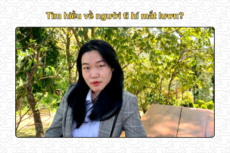 tìm hiểu về người ti hí mắt lươn