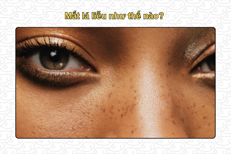Mắt lá liễu như thế nào?