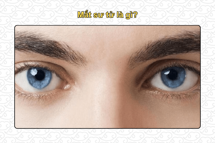Mắt sư tử là gì?