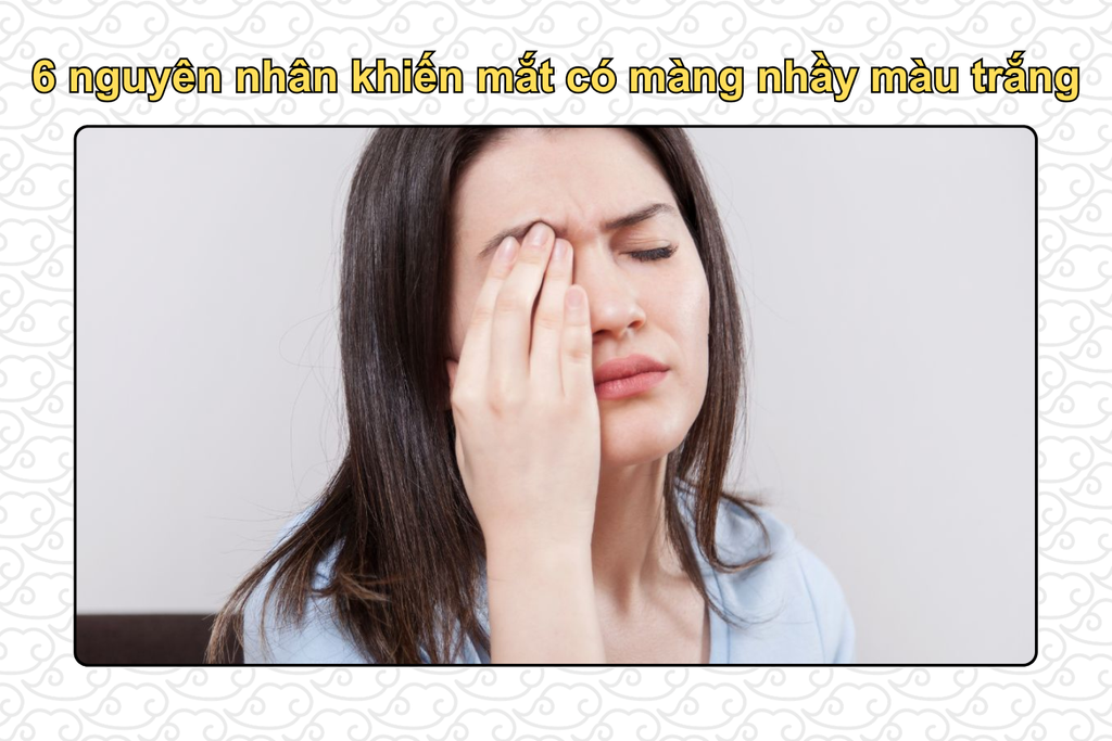 nguyen-nhan-khien-mat-co-mang-nhay-mau-trang