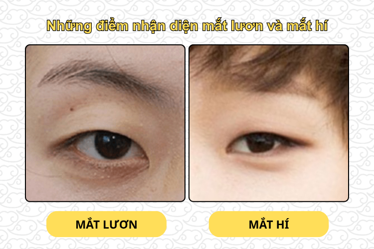 Những điểm nhận diện mắt lươn và mắt hí