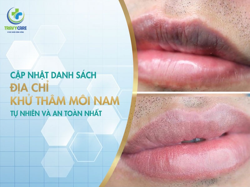 Cập nhật danh sách địa chỉ khử thâm môi nam tự nhiên và an toàn nhất