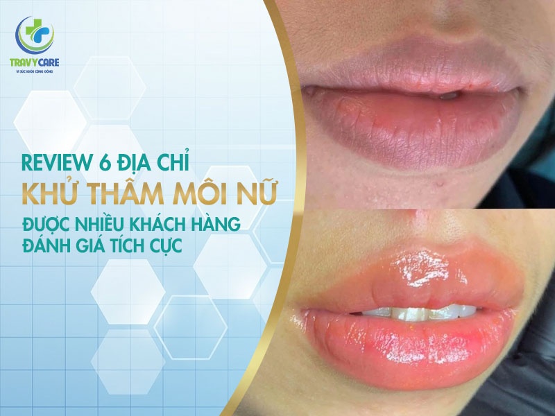 Review 6 địa chỉ khử thâm môi nữ được nhiều khách hàng đánh giá tích cực