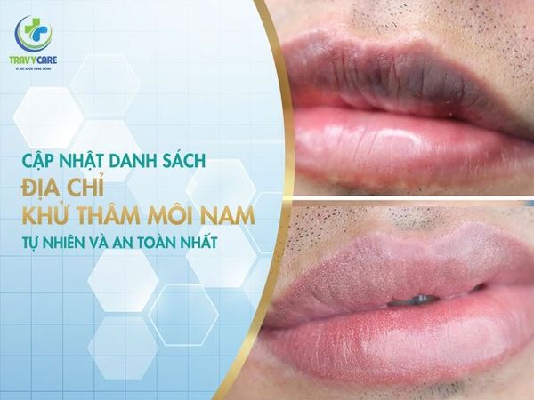 Hình ảnh đôi môi nam sau khi tìm được cơ sở khư thâm uy tín