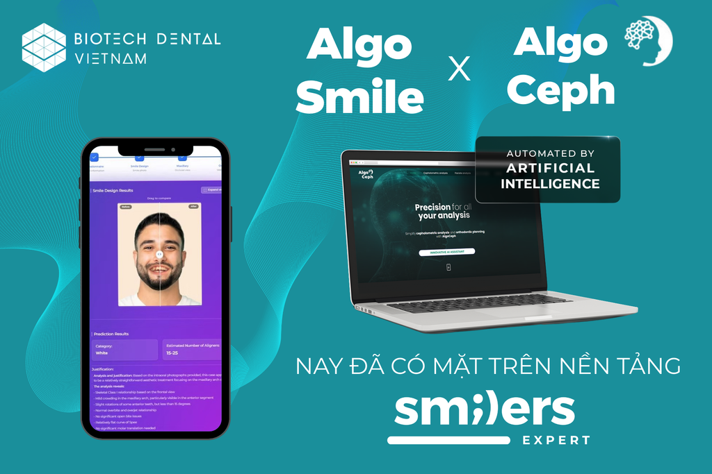 SMILERS EXPERT CHÍNH THỨC RA MẮT: ALGOSMILE & ALGOCEPH