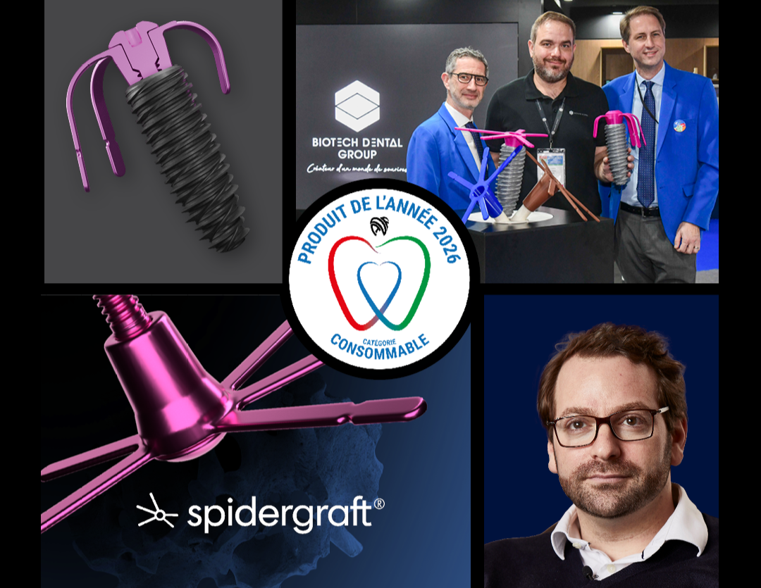 PHÁT MINH ĐỔI MỚI CỦA NĂM GỌI TÊN SPIDERGRAFT