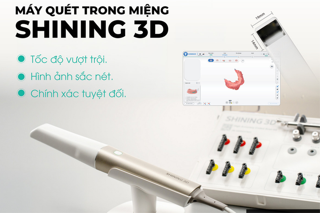 CHÍNH THỨC PHÂN PHỐI: MÁY QUÉT TRONG MIỆNG SHINING 3D!
