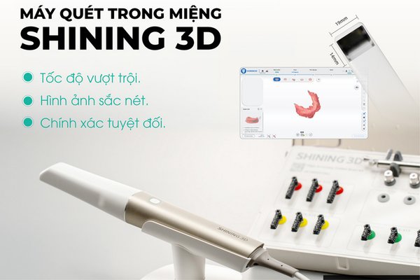 CHÍNH THỨC PHÂN PHỐI: MÁY QUÉT TRONG MIỆNG SHINING 3D!