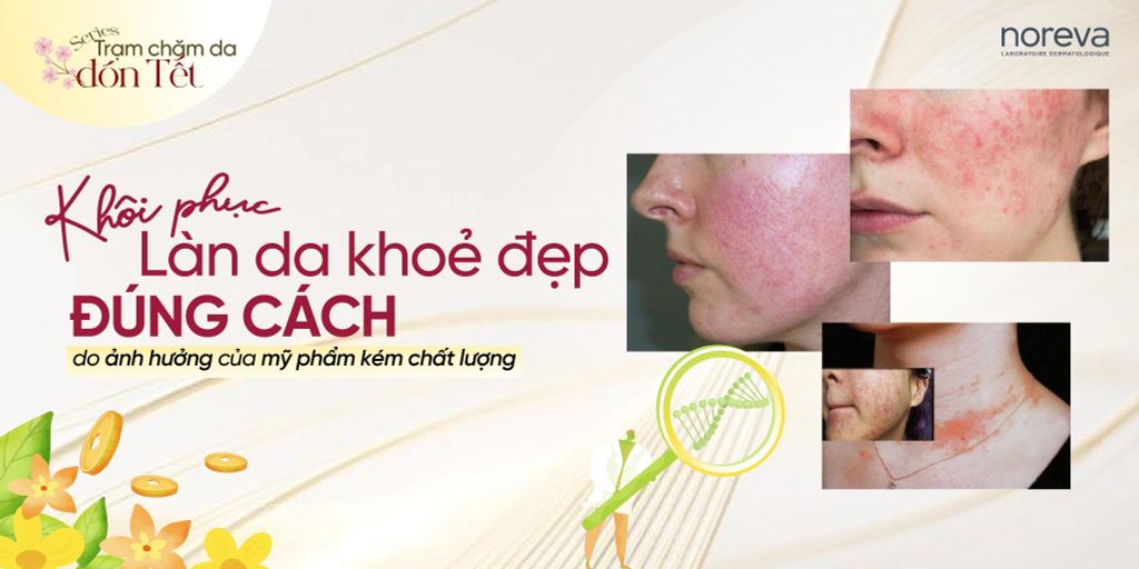 PHỤC HỒI LÀN DA KHỎE ĐẸP ĐÚNG CÁCH