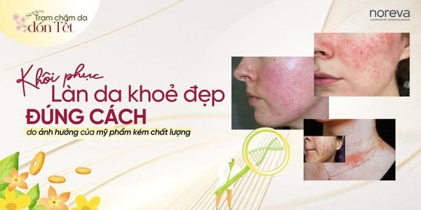 PHỤC HỒI LÀN DA KHỎE ĐẸP ĐÚNG CÁCH