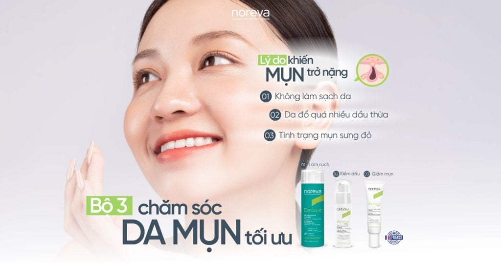 TOP CÁC LÝ DO KHIẾN DA MỤN TRỞ “NẶNG”?