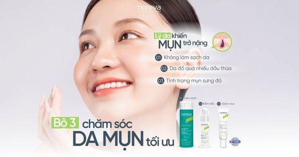 TOP CÁC LÝ DO KHIẾN DA MỤN TRỞ “NẶNG”?