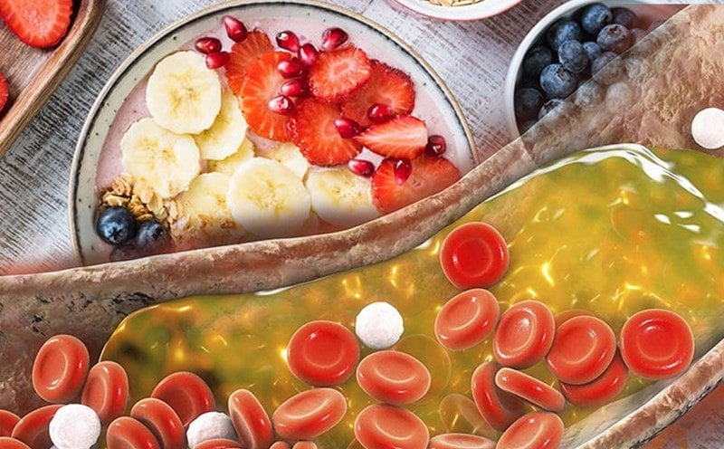5 thói quen buổi sáng giúp kiểm soát cholesterol xấu và bảo vệ tim mạch